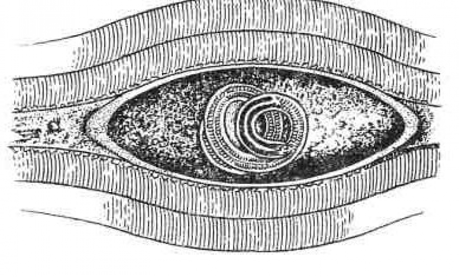 Рисунок трихинеллы в мышцах с обозначениями личинка